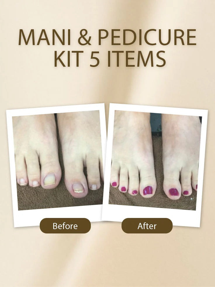 Advertisement for Golden Girl Mani & Pedicure Kit 5 Items with 'Before' and 'After' foot images on a beige background.