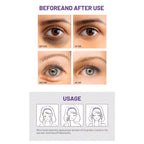 Before and after use comparison of Disaar Anti-Aging Retinol Eye Cream – 25g with usage instructions.