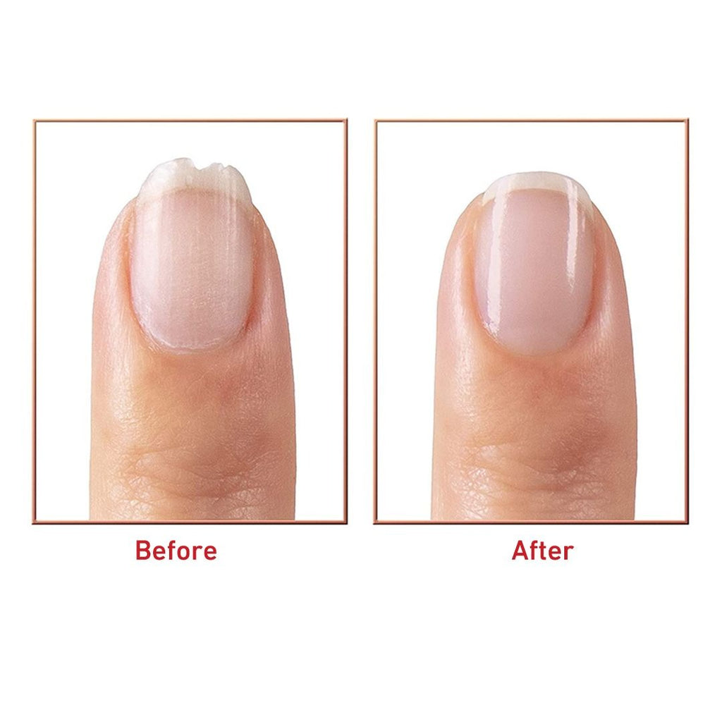 Before and after comparison of a manicured nail with Flowers Salon Nail Beauty Care Rechargeable
