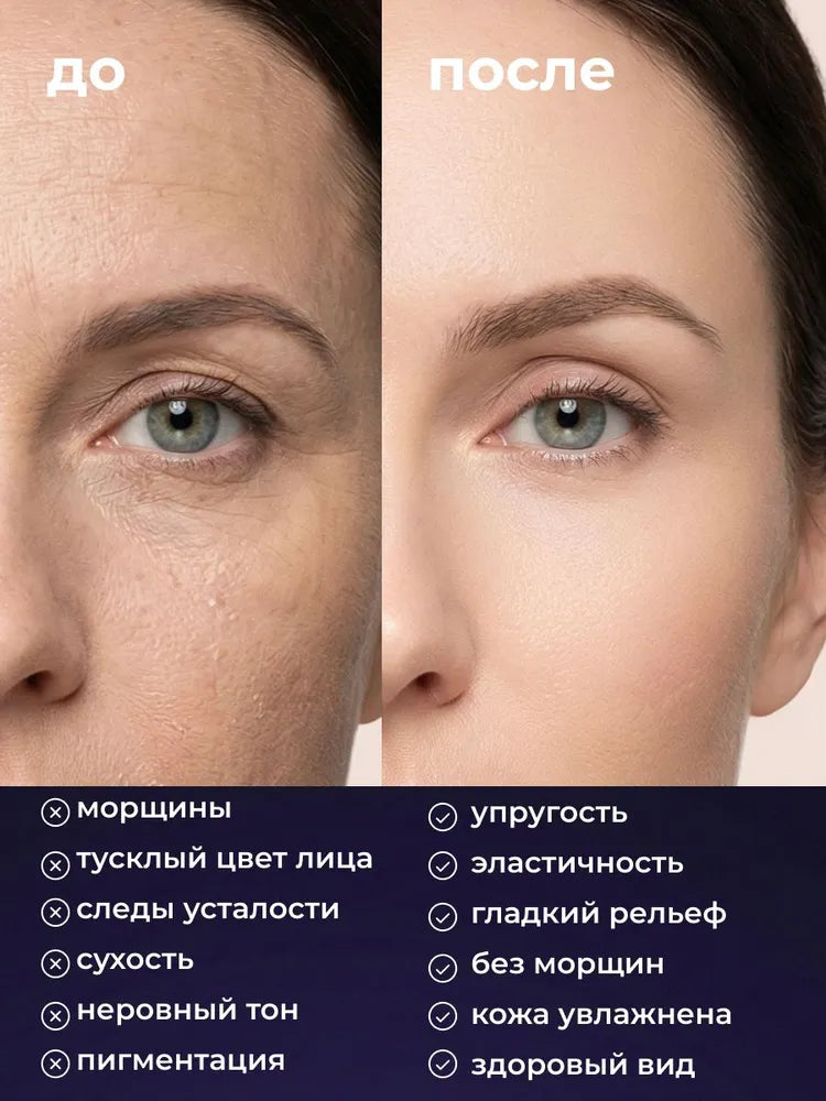 Before and after comparison of a woman's face with text describing skin improvements.