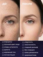 Before and after comparison of a woman's face with text describing skin improvements.
