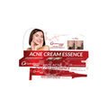 Acne cream essence packaging with a woman's face on a white background