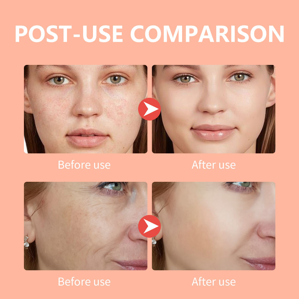 Before and after comparison of facial skin treatment on a peach-colored background