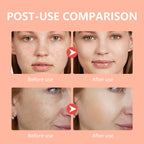 Before and after comparison of facial skin treatment on a peach-colored background