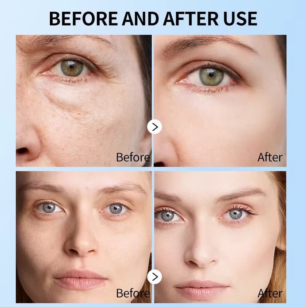 Before and after use comparison of Mooyam Pearl Real Capsule Sheet Mask use on a person's face.