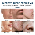 Skincare product advertisement showing various skin issues and solutions.
