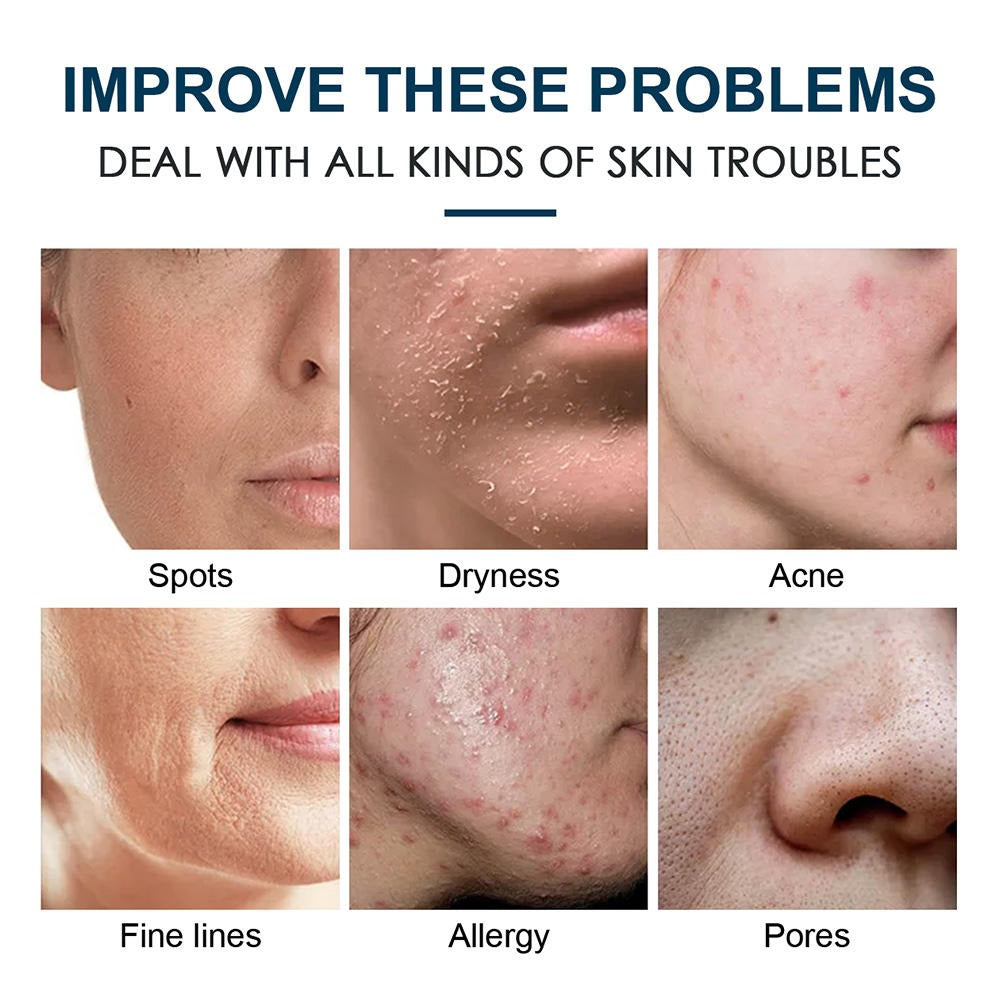 Skincare product advertisement showing various skin issues and solutions.