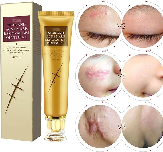 Scar Remover Gel for Scars, Scar Repairing Gel