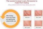 Scar Remover Gel for Scars, Scar Repairing Gel