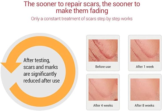 Scar Remover Gel for Scars, Scar Repairing Gel